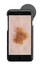 HEINE iC1, Digitalt Dermatoskop til iphone 7/8