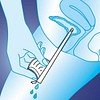 Emteva Pure, kvindekateter, PVC-fri, 13cm, steril, ch 12