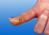 Rudaderm, fingerplaster, lille, beige, steril.