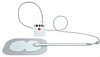 PICO 14 Multisite, kit med pumpe og 2 bandager, steril, 20 cm x 25 cm