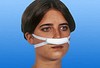 Nobarhinal, post-op næseforbinding med fikseringsbånd, basic