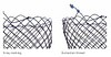 Micro-Tech, Duodenal Stent part-covered, TTS, Introduc 180 cm, Ø 20 mm L: 60 mm