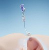 Freka, gastrotube, udskiftningssonde, steril, ch 15