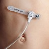 Freka Belly Button, gastrostomiknapsonde, 1,5 cm, steril, FR 14