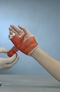 Soft Cast, syntetisk gipsbandage, rød, 5 cm x 3,6 m
