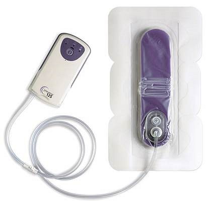 Prevena, Peel&place kit, m pumpe 20CM, steril, 20 cm
