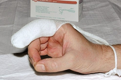 Nobatricot-Plus, fingerforbinding str. large, steril