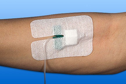 Rudaven plus, IV bandage med kompres, non woven, steril, 6 cm x 8 cm