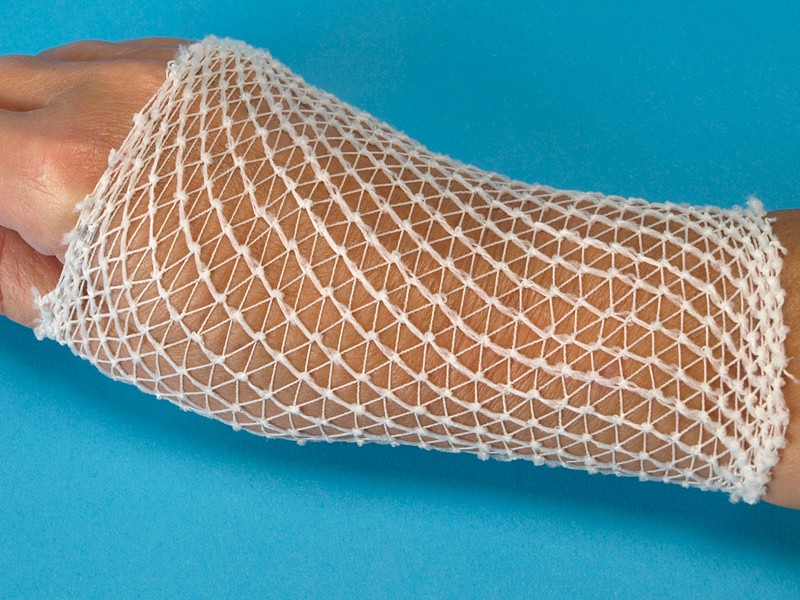 Nobanetz, elastisk netfiksering, hånd nr. 1