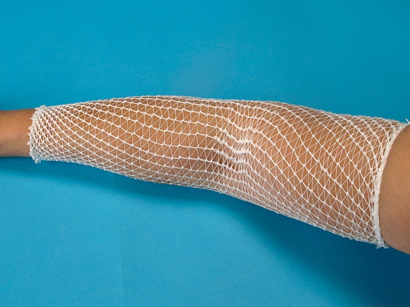 Nobanetz, elastisk netfiksering, arm nr. 2, 25 m