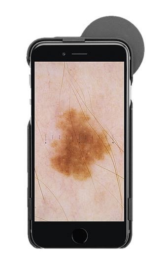 HEINE iC1, Digitalt Dermatoskop til iphone 7/8