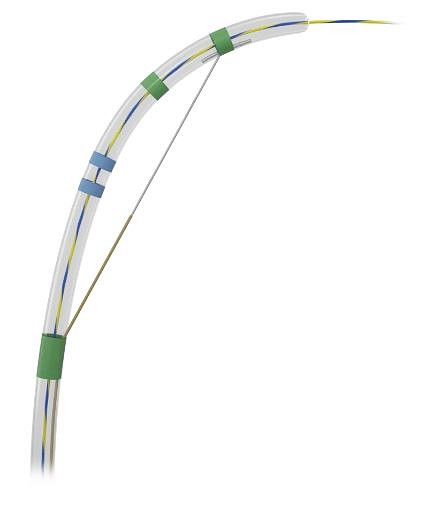 Micro-Tech Sphinx Papillotome, Pre-loaded,3-lumen,0.035 mm st., 25 mm/260 cm