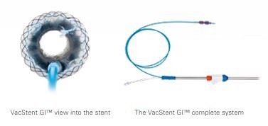 Micro-tech VAC GI stent, full covered, preloaded OTW, m svamp, Ø: 14mm L: 1000 mm