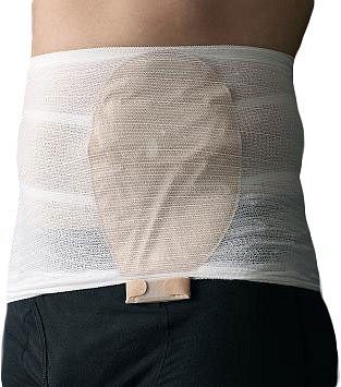 StomaSafe, stomifiksering, omkreds 115-145cm, hvid, x-large