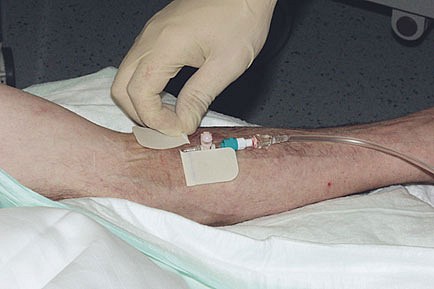 Rudaven transparent, IV bandage, PU film, steril, 6 cm x 8 cm