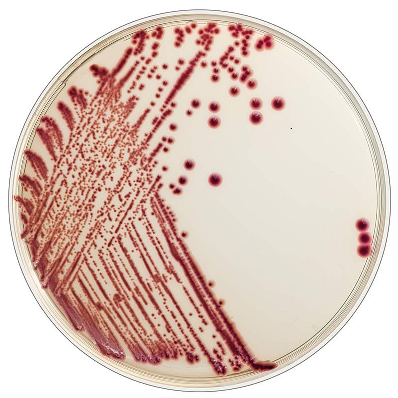 Flexicult, Chrom agar Flexicult ID