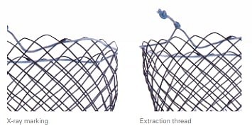 Micro-Tech, Duodenal Stent part-covered, TTS, Introduc 180 cm, Ø 20 mm L: 80 mm