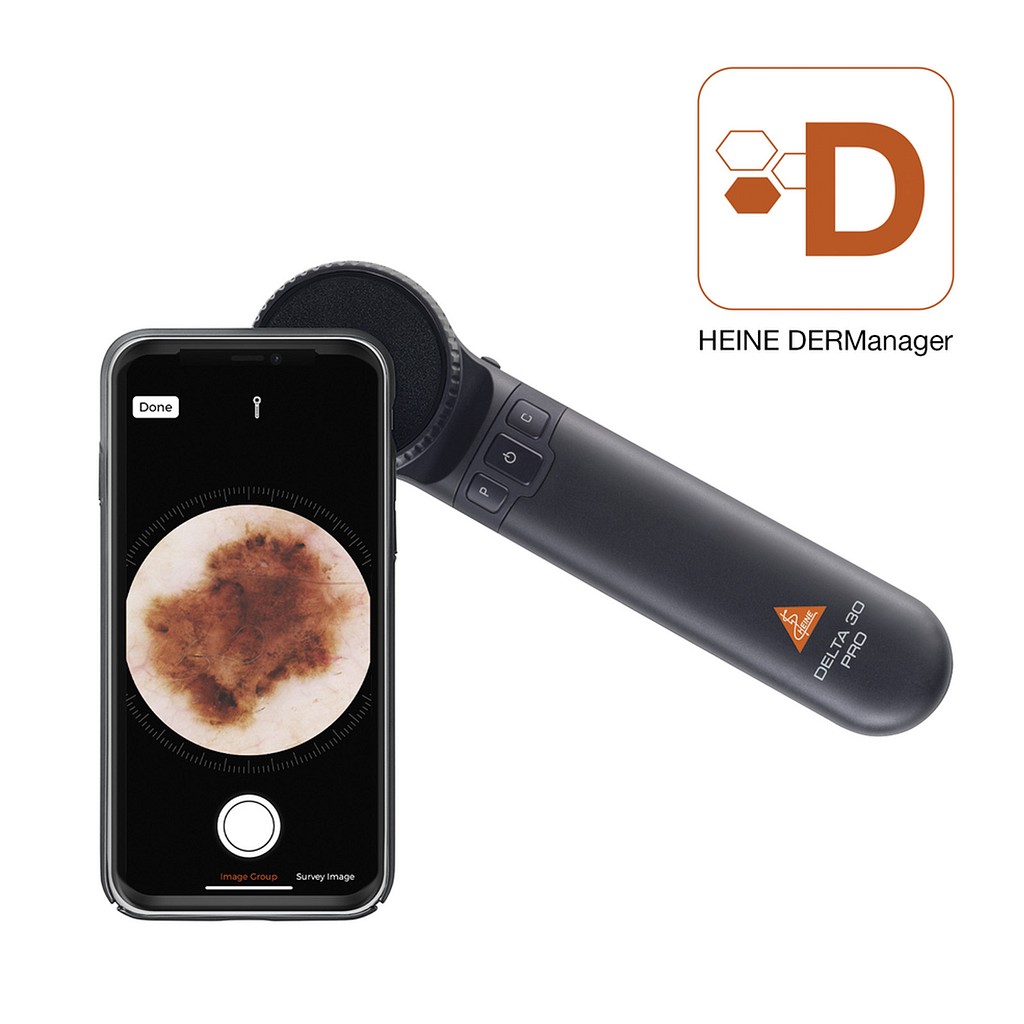 Heine Delta 30 Pro Bundle, dermatoskopsæt komplet