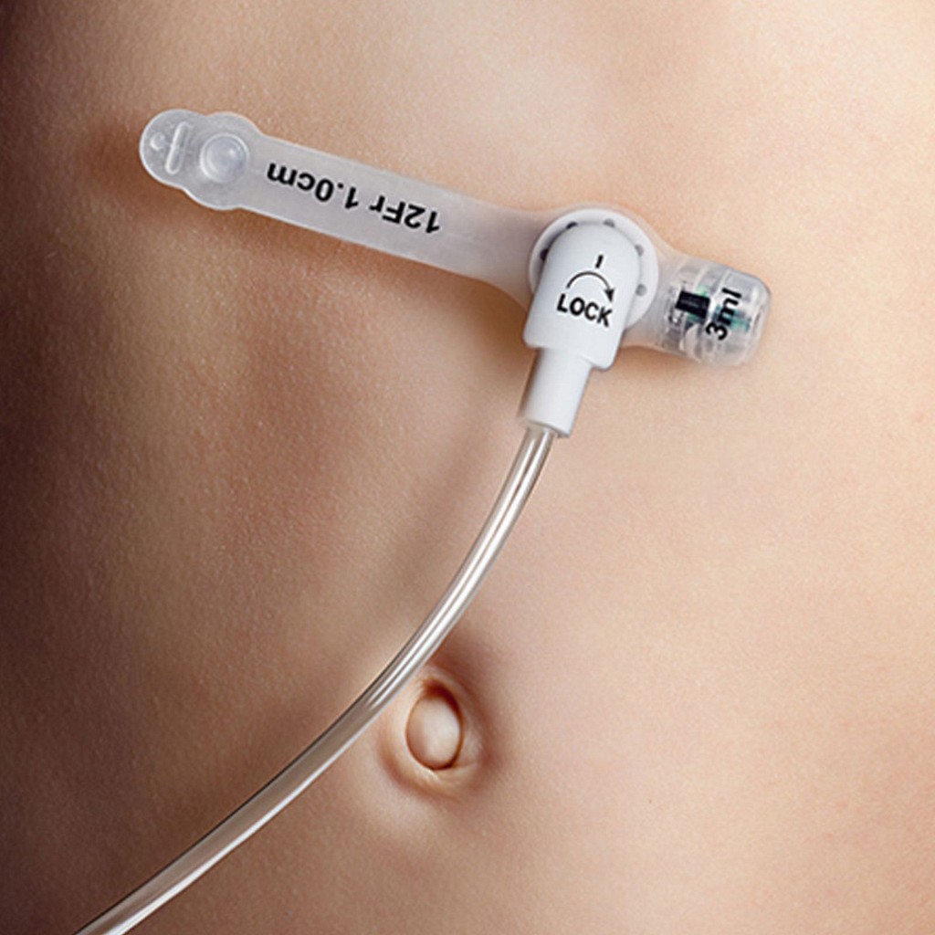 Freka Belly Button, gastrostomiknapsonde, 3,5 cm, steril, FR 16