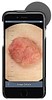 HEINE iC1 digit dermatoskooppisetti iPhone 7/8