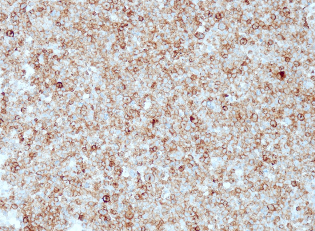 pan-TRK (QR008) Rb 0,1 ml konsentraatti