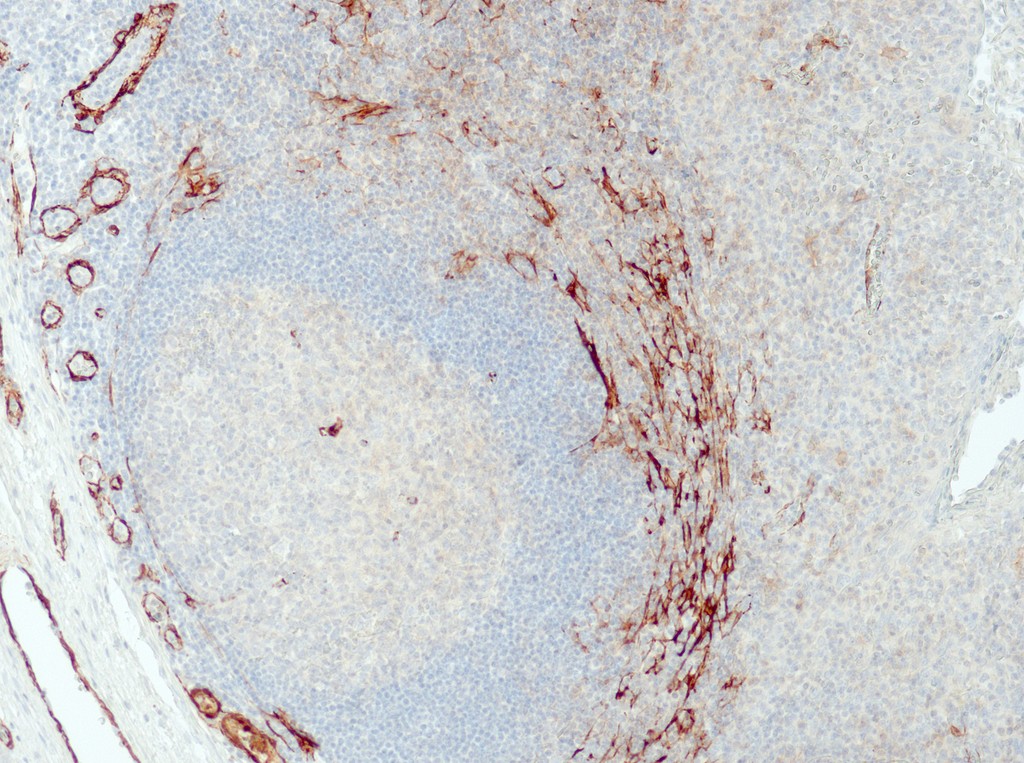 SMA (QR110) Rb 0,1 ml konsentraatti