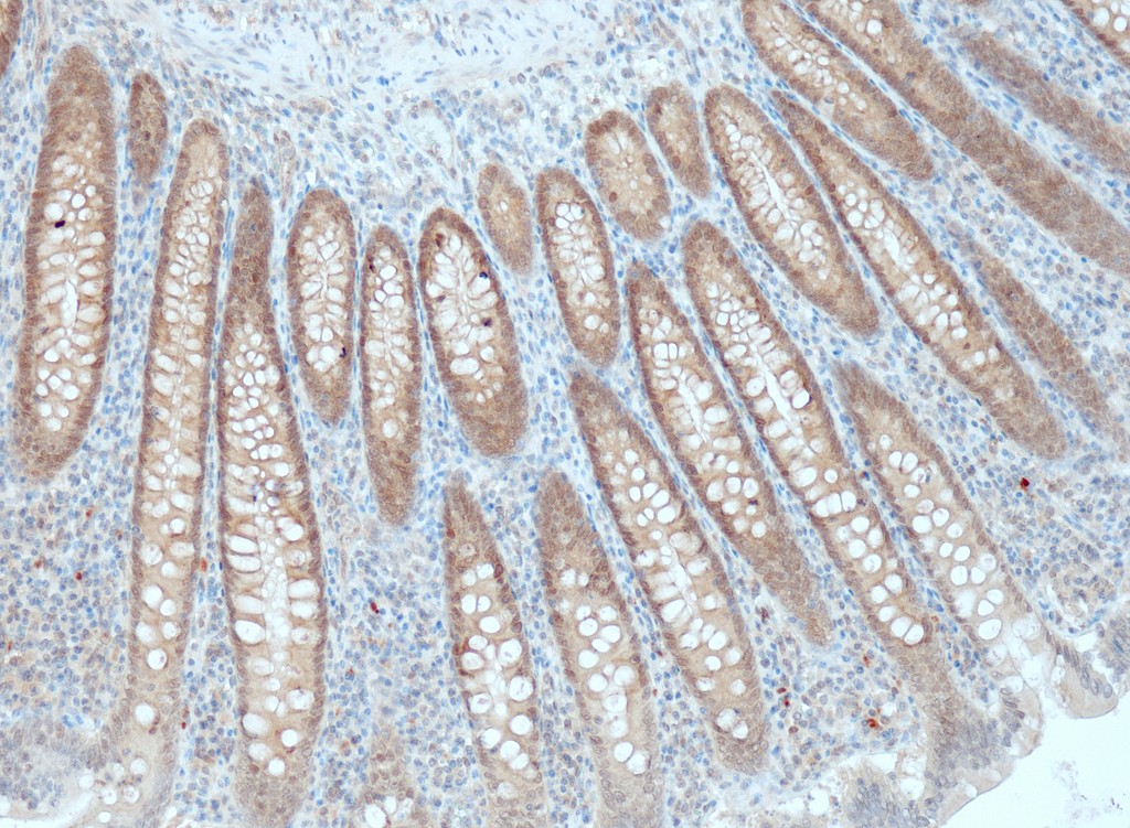SMAD4 (QR029) Rb 0,1 ml konsentraatti