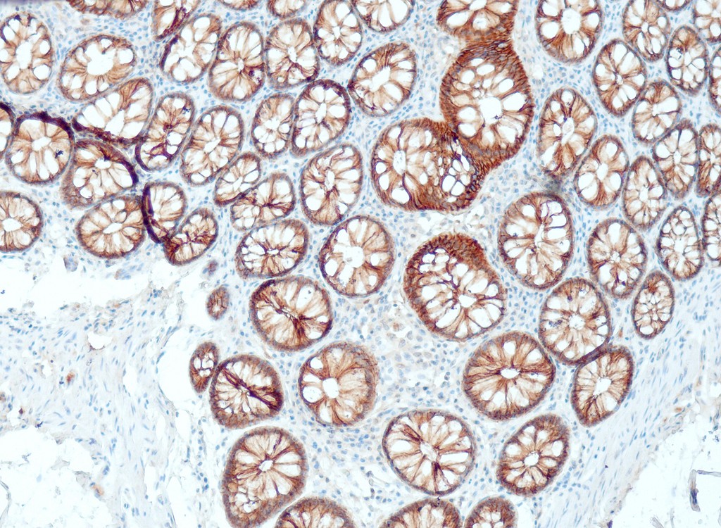 E-Cadherin (QR035) Rb 3 ml RTU liuos