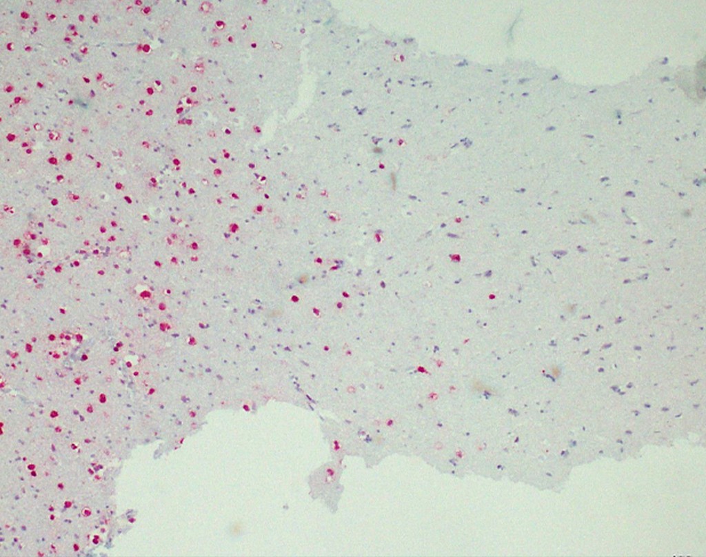 IDH1 R132H (QM002) Ms 1,0 ml konsentraatti