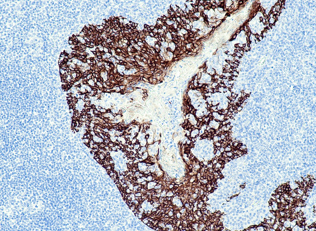 Cytokeratin 5 (QR027) Rb 0,1 ml konsentraatti