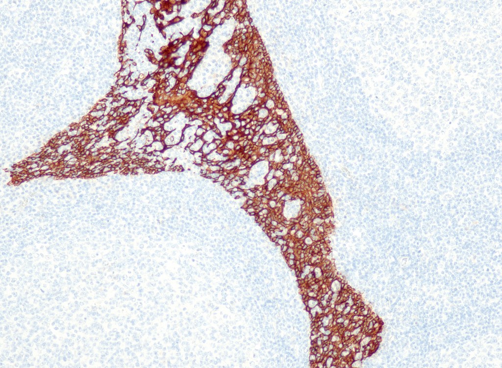Cytokeratin 5/6 (QR027 & QR028) Rb 1,0 ml konsentraatti