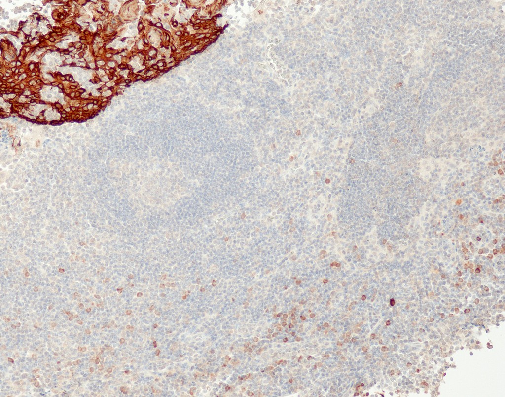 Cytokeratin 5/14 (QR027 & QR057) Rb 3 ml RTU liuos