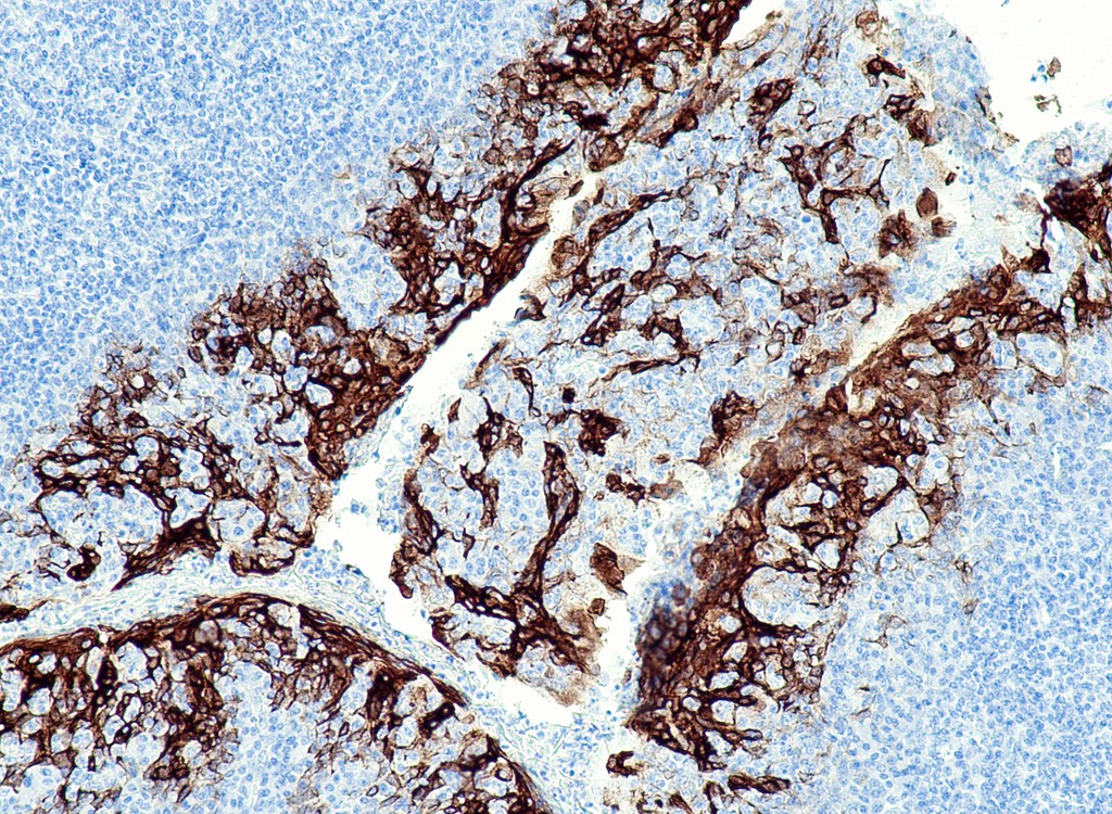 Cytokeratin 6 (QR028) Rb 1,0 ml konsentraatti
