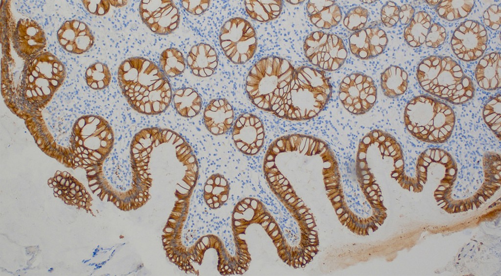 Cytokeratin 20 (Ks20.8) Ms 0,5 ml konsentraatti