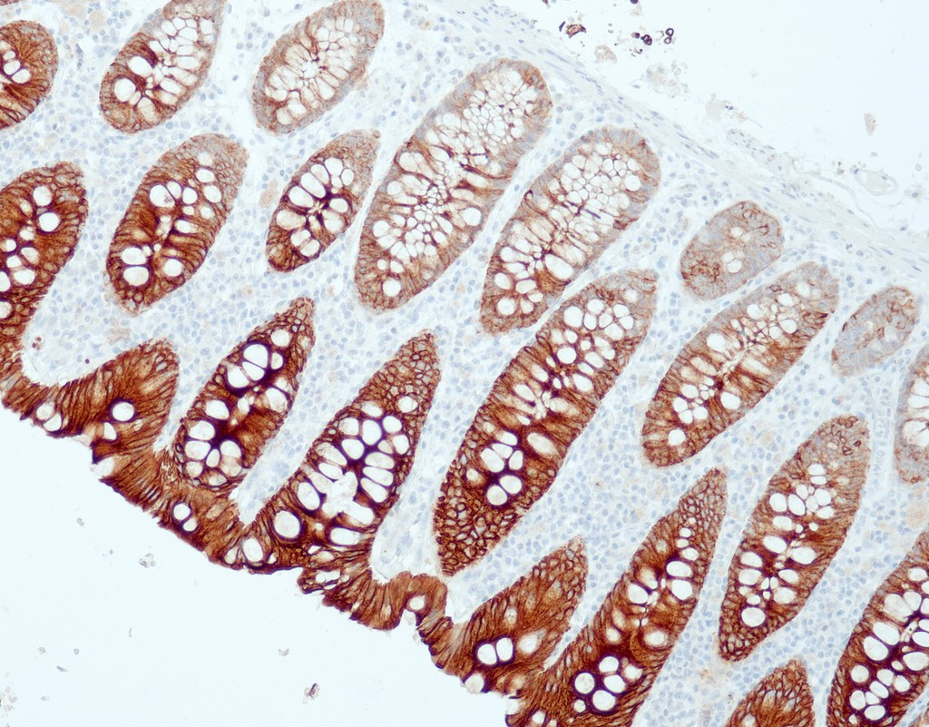Cytokeratin 19 (QR125) Rb 1,0 ml konsentraatti