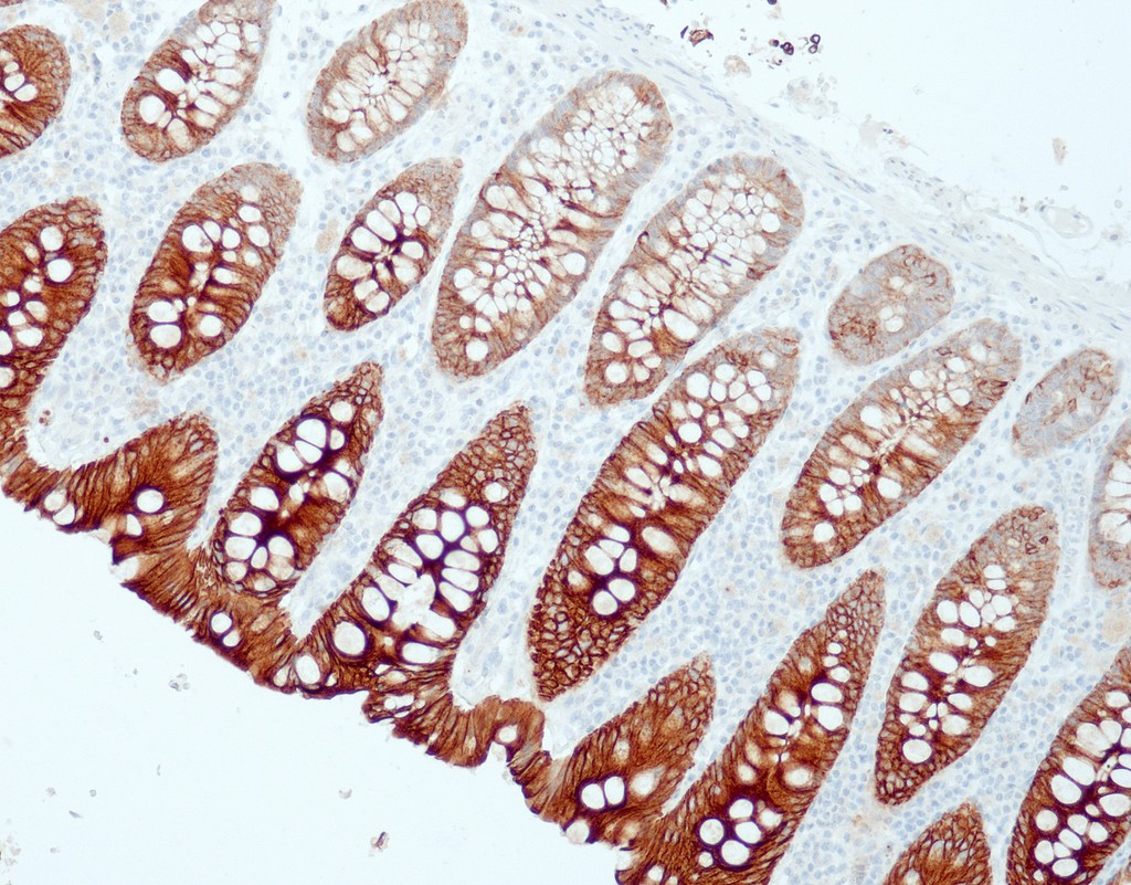 Cytokeratin 19 (QR125) Rb 3 ml RTU liuos