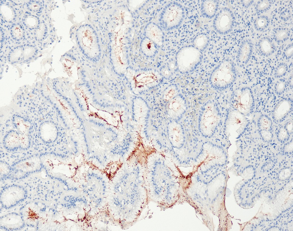 Helicobacter pylori (QR091) Rb 1,0 ml konsentraatti