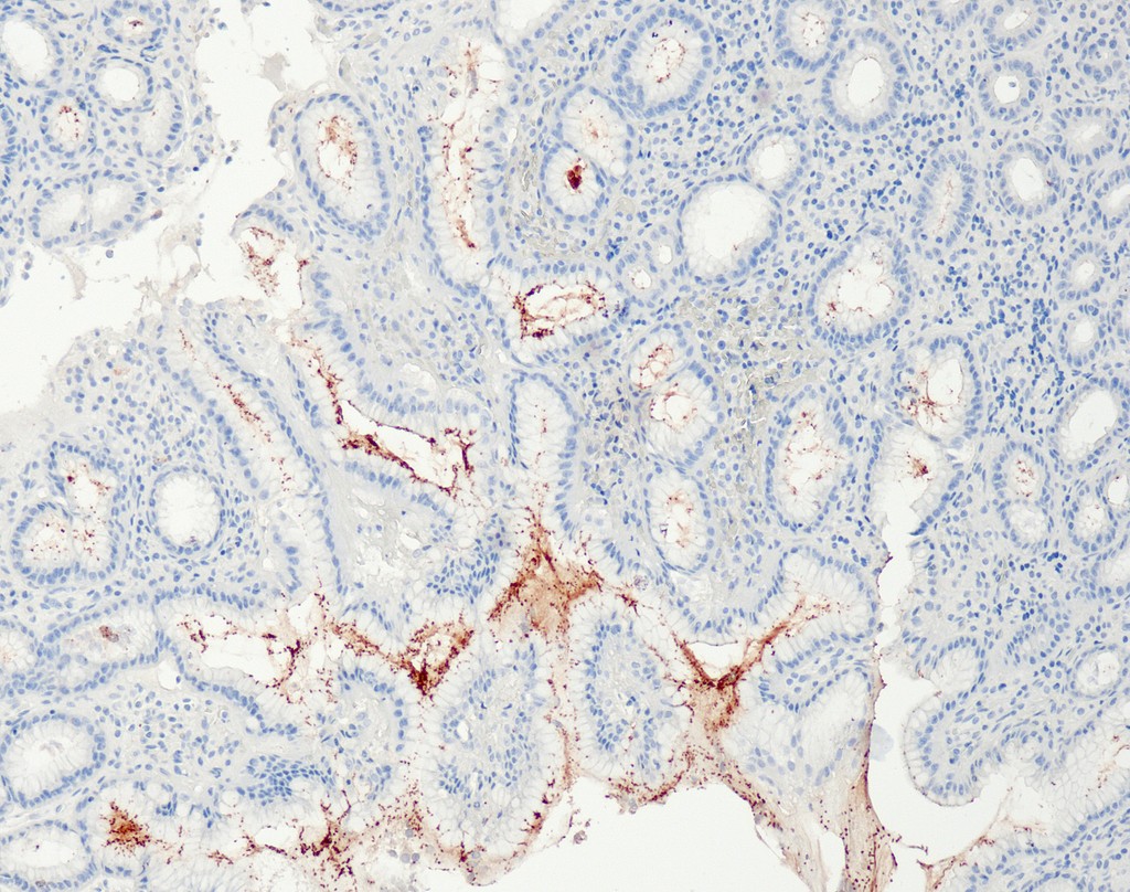 Helicobacter pylori (QR091) Rb 3 ml RTU liuos