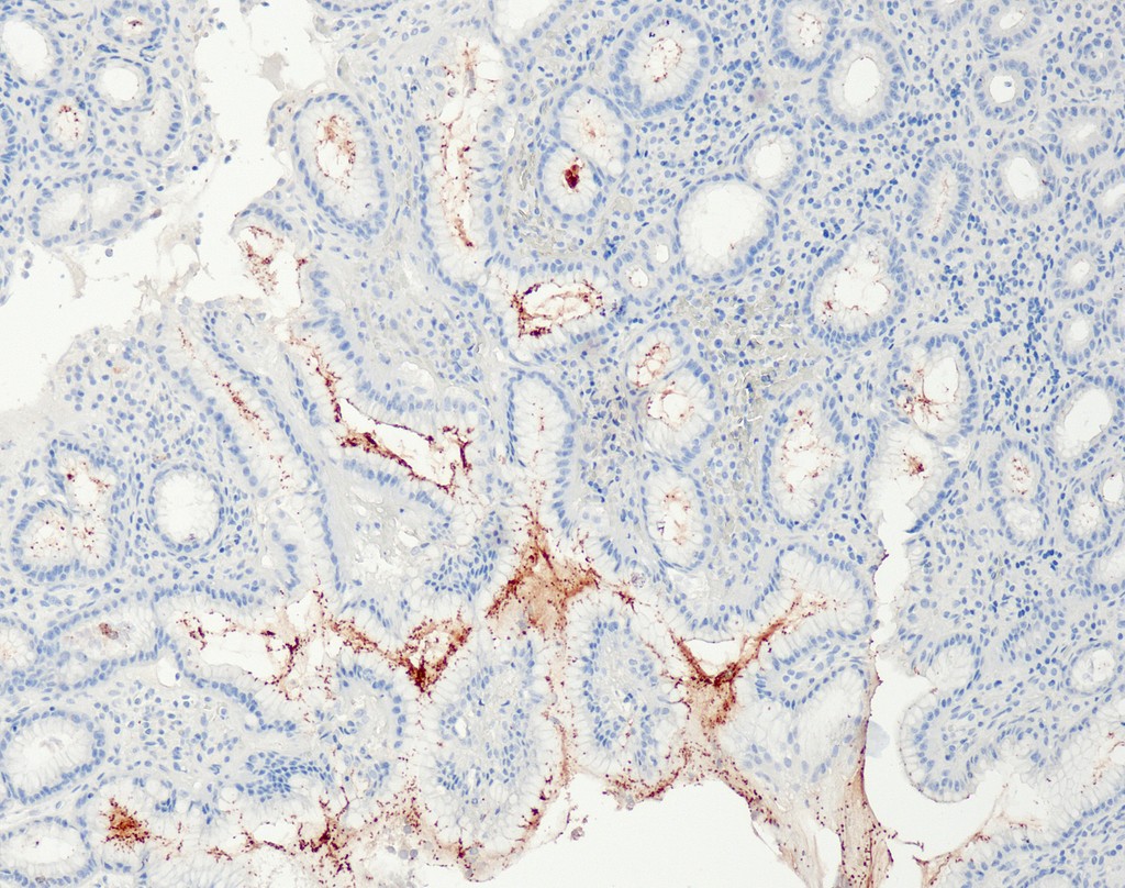 Helicobacter pylori (QR091) Rb 7 ml RTU liuos