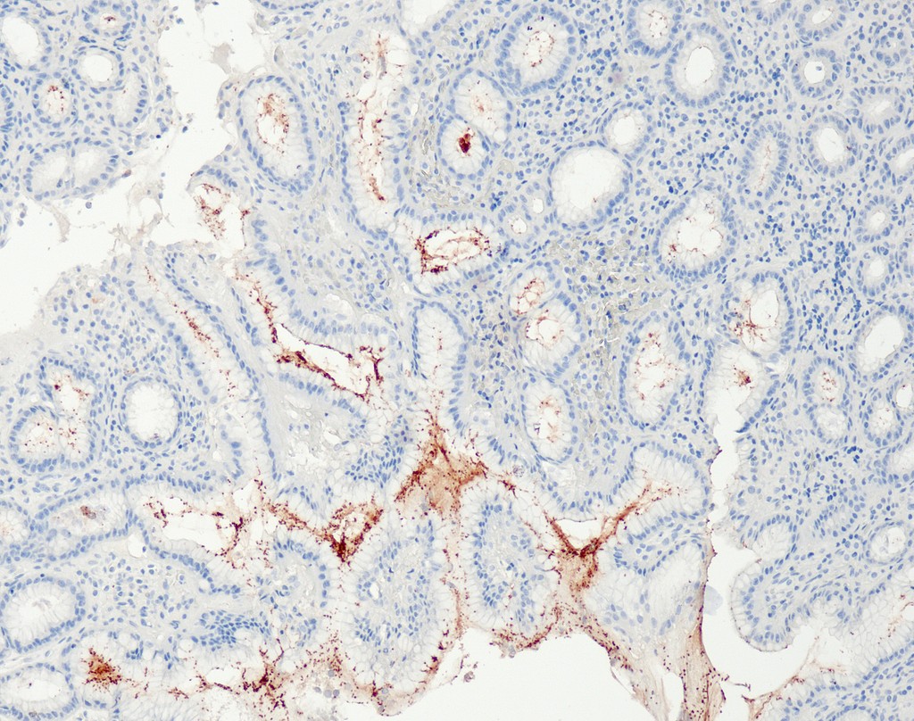 Helicobacter pylori (QR091) Rb 15 ml RTU liuos