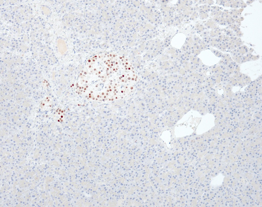 INSM1 (QR128) Rb 3 ml RTU liuos