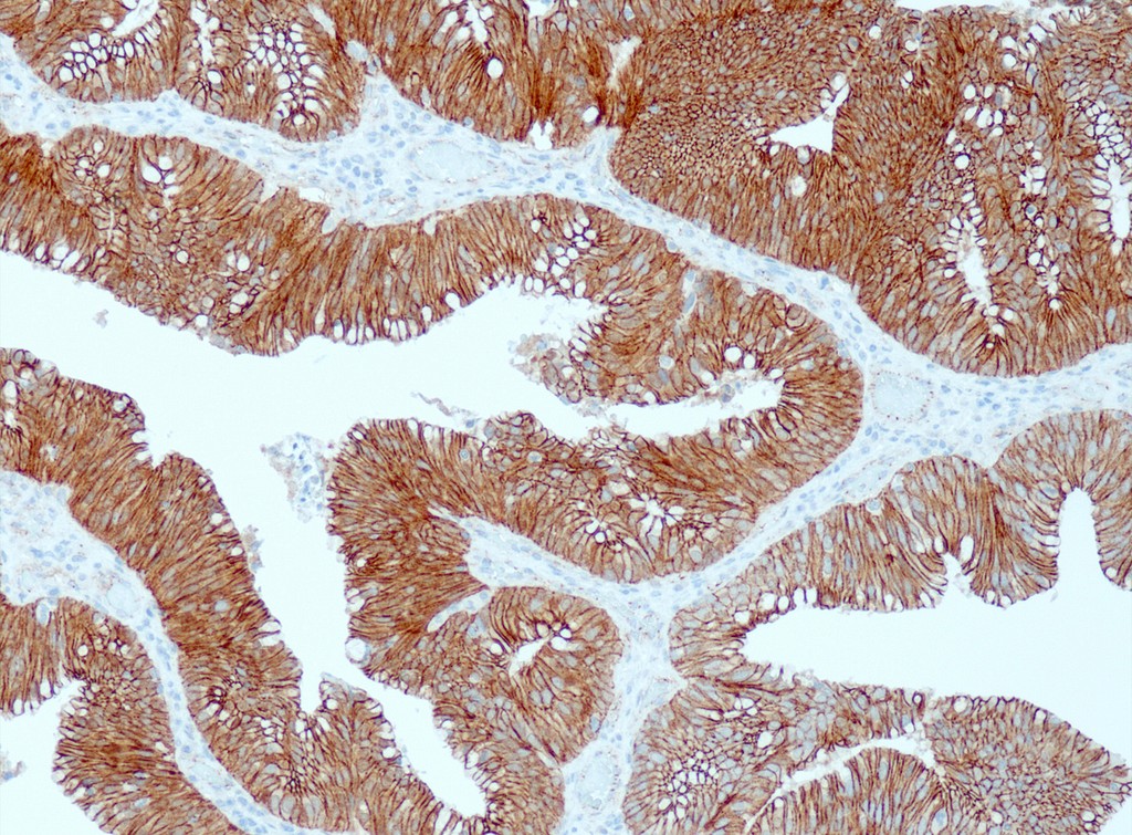 Beta-Catenin (QR095) Rb 7 ml RTU
