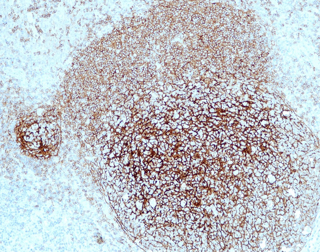CD21 (QR076) Rb 0,5 ml konsentraatti