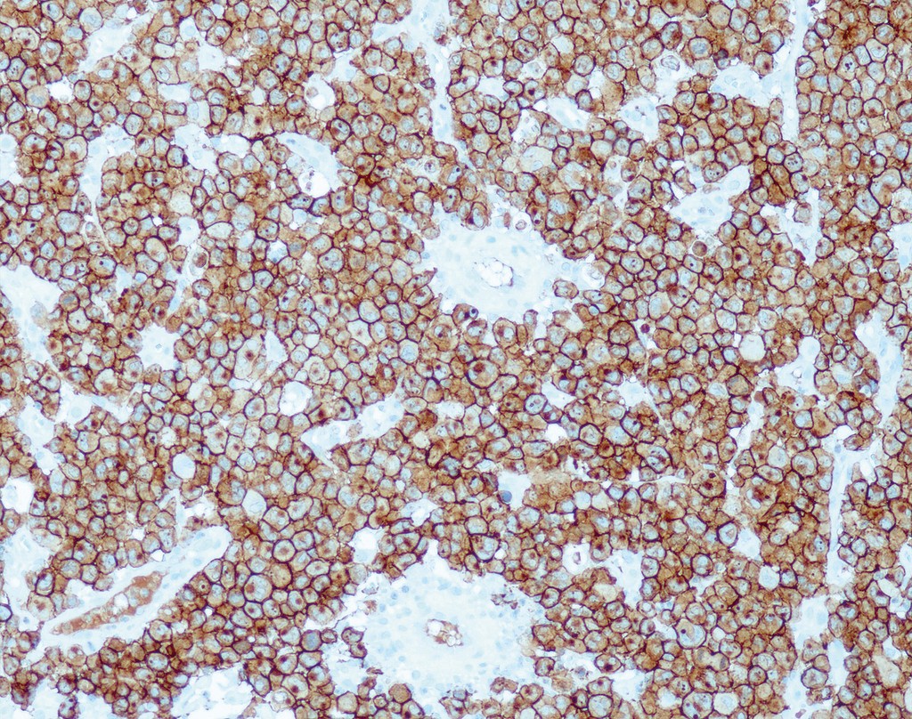 CD30 (QR109) Rb 3 ml RTU liuos