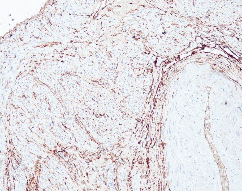 CD34 (QR093) Rb 7 ml RTU liuos