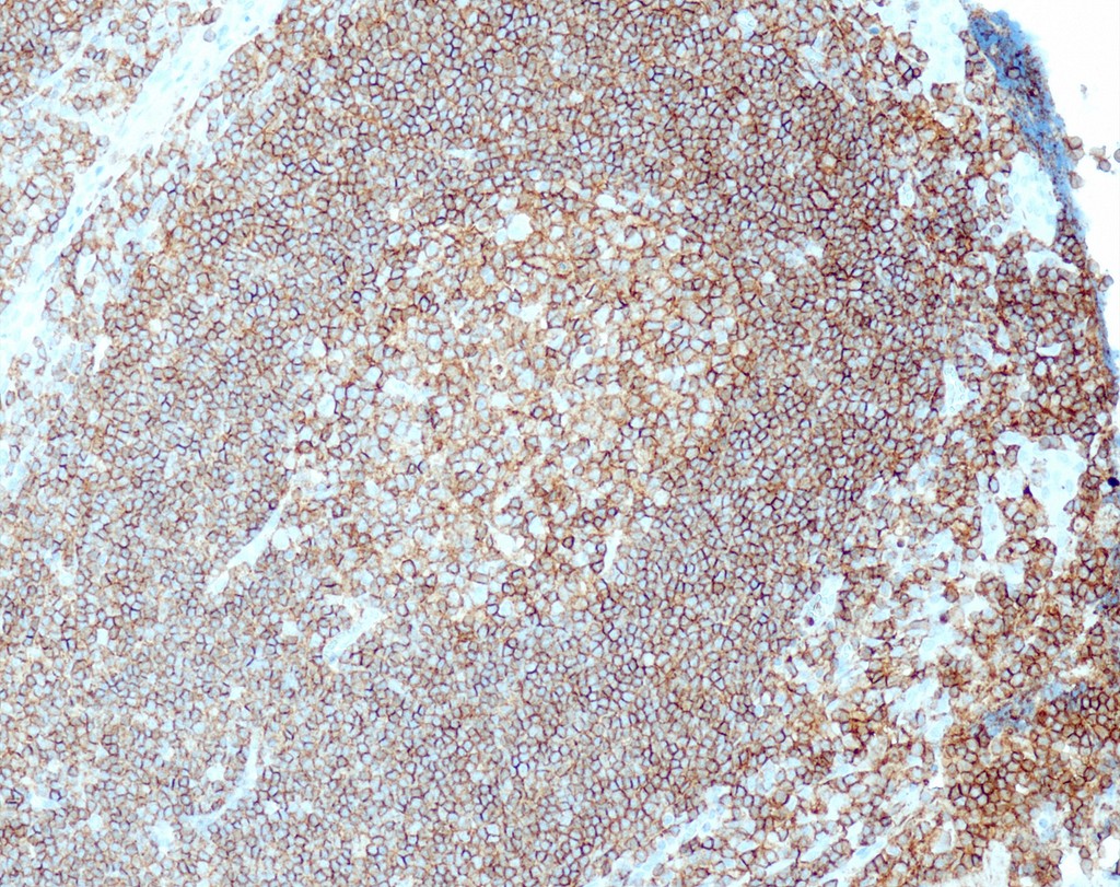 CD45/LCA (QR016) Rb 3 ml RTU liuos