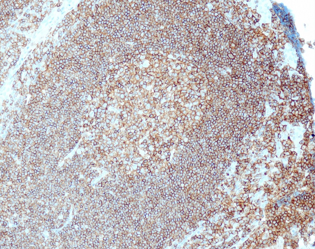 CD45/LCA (QR016) Rb 7 ml RTU liuos