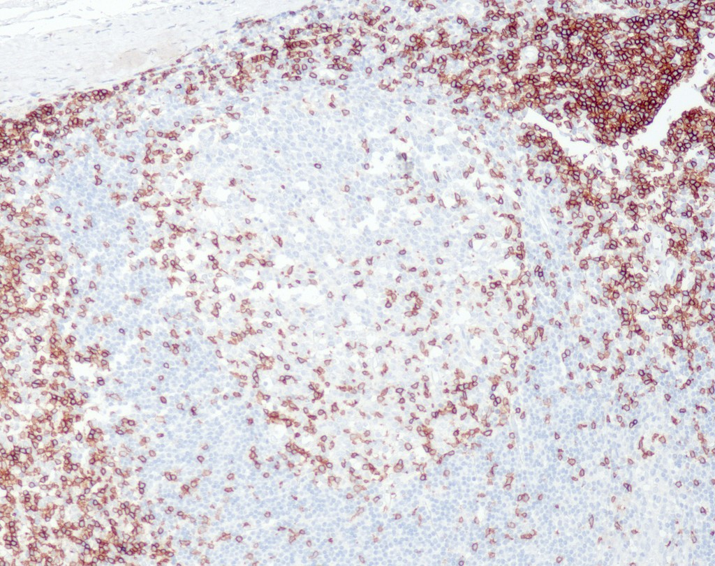 CD3e (QR004) Rb 7 ml RTU liuos