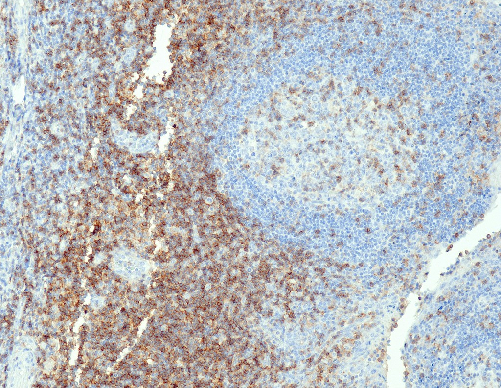 CD4 (QR032) Rb 3 ml RTU liuos