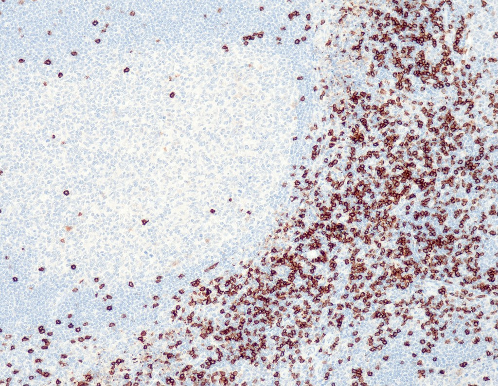 CD8 (QR068) Rb 7 ml RTU liuos